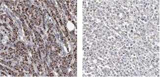 anti-acsf2-antibody anti-acsf2-antibody