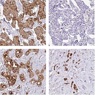 anti-agr3-antibody anti-agr3-antibody