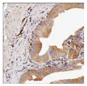 Immunoperoxidase staining of formalin-fixed Immunoperoxidase staining of formalin-fixed