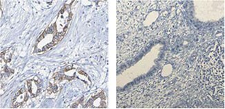 anti-gcm1-antibody anti-gcm1-antibody