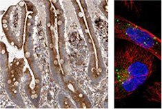 ihc-analysis-using-the-anti-grn-antibody ihc-analysis-using-the-anti-grn-antibody