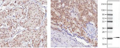 Immunohistochemical analysis of RBM3 expression in breast cancer (left) and prostate cancer (right) using AMAb90655 shows nuclear positivity in tumor cells. The WB image shows an expected band of 17 kDa in human cell line RT4 lysate using AMAb90655. RBM3 Antibodies