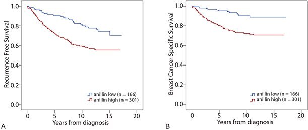 Kaplan-Meier (survival) analysis of recurrence free- (A) and breast cancer specific survival (B) according to aniliin expression for breast cancer patients. Patients were split into two groups based on high and low anillin expression. kaplan-meier-survival-analysis-2