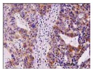 1.5 μg/mL using human stomach carcinoma tissue 1.5 μg/mL using human stomach carcinoma tissue