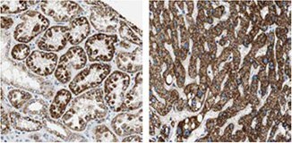 p5c-dehydrogenase-aldh4a1 p5c-dehydrogenase-aldh4a1