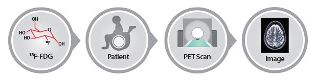Positron Emission Tomography