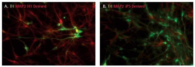 Dopaminergic differentiation of iPSC derived NPCs Dopaminergic differentiation of iPSC derived NPCs