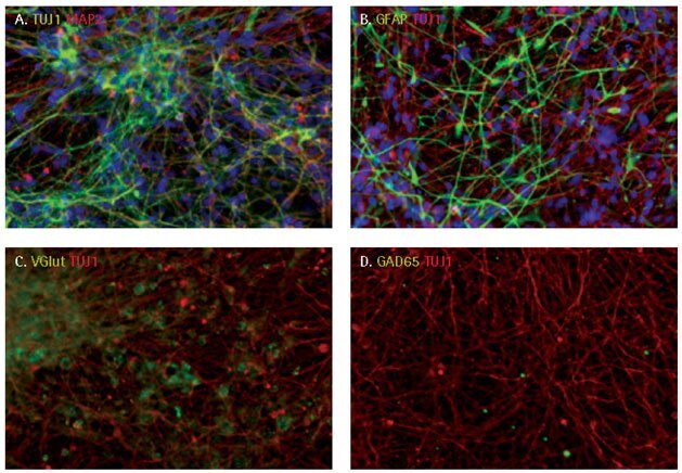 Neuronal differentiation of iPSC derived NPCs. Neuronal differentiation of iPSC derived NPCs.