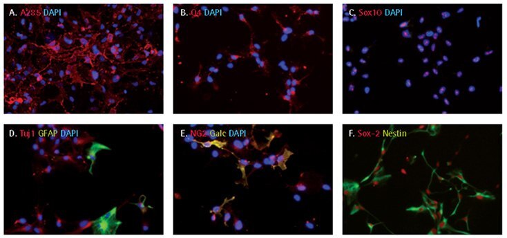 Oligodendrocyte differentiation of iPS cell derived NPCs Oligodendrocyte differentiation of iPS cell derived NPCs