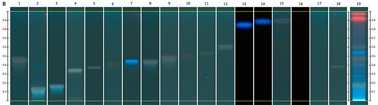 Chromatograms under UV