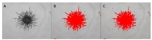 Process for analysis of 3D invasion