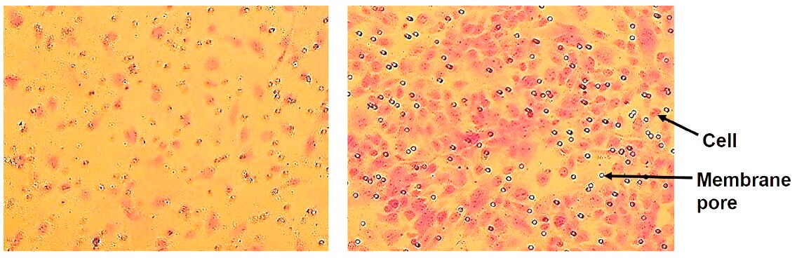 In vitro cell migration of endothelial cells stimulated by VEGF. In vitro cell migration of endothelial cells stimulated by VEGF.