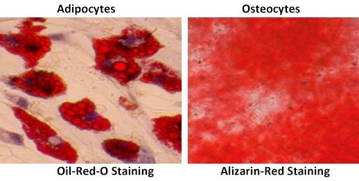 adipocytes and osteocytes adipocytes and osteocytes