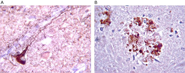 amyloid-antibody Anti-β-Amyloid antibody staining