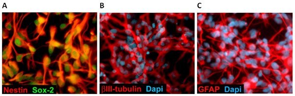 Multipotent NSCs express Nestin/Sox-2 and can differentiate into BIII-Tubulin positive neurons <b>(B)</b> or GFAP positive astrocytes <b>(C)</b> under appropriate culture conditions. Differentiation of Neural Stem Cells.