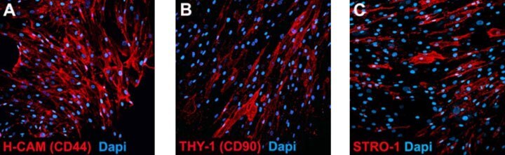 ICC staining of cultured human bone marrow-derived mesenchymal stem cells with antibodies provided in the Human Mesenchymal Stem Cell Characterization Kit. Human Mesenchymal Stem Cell express H-CAM (CD44) (A, CBL154; 1/500 dilution), THY-1 (CD90) (B, CBL415: 1/500 dilution) and STRO-1 (C, MAB4315: 1/500 dilution). Nuclei of the cells were visualized with DAPI (blue). Expression of hematopoietic stem cell markers, CD19 (MAB1794) and CD14 (MAB1219) and endothelial marker, CD146 (MAB16985) were not observed in human mesenchymal stem cells (data not shown). ICC staining of cultured human bone