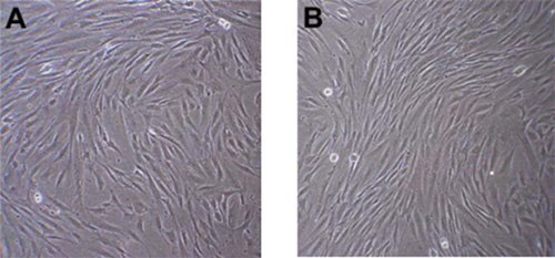 Phase contrast images of Human Mesenchymal Stem Cells one (A) and two (B) days after thawing. Note spindle shaped, fibroblast-like morphology. Right before passaging, cells should be ~80% confluent. Phase contrast images of Human Mesenchymal Stem Cells
