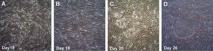 LIGHT DIAGNOSTICS Time course of human iPSC colonies generation using Human Simplicon RNA Reprogramming Kit