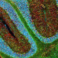 fluorescent microscopy