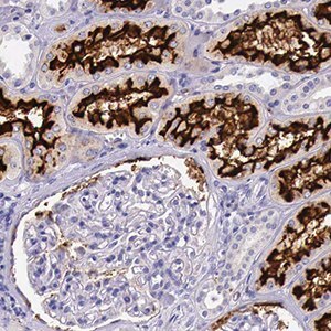Immunohistochemical staining of human kidney tissue sections Immunohistochemical staining of human kidney tissue sections