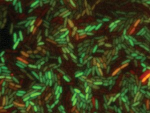 バクテリアのシングル細胞応答解析 バクテリアのシングル細胞応答解析