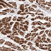 Anti-CDK20 antibody produced in rabbit Prestige Antibodies® Powered by Atlas Antibodies, affinity isolated antibody, buffered aqueous glycerol solution, ab3
