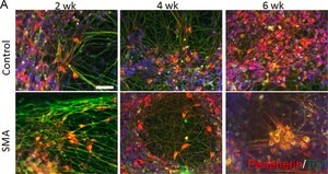 Anti-Peripherin Antibody serum, Chemicon®