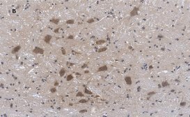 Anti-Choline Acetyltransferase (ChAT) Antibody, clone 2K16, ZooMAb® Rabbit Monoclonal recombinant, expressed in HEK 293 cells