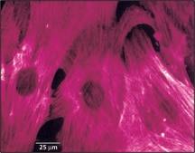 Monoclonal Anti-Actin, α-Smooth Muscle clone 1A4, ascites fluid