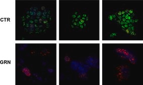 Anti-Histone H2A.X Antibody serum, Upstate®