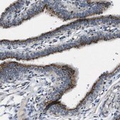 Anti-ZFPL1 antibody produced in rabbit Prestige Antibodies® Powered by Atlas Antibodies, affinity isolated antibody, buffered aqueous glycerol solution