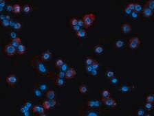 Duolink® In Situ Red Starter Kit Mouse/Rabbit