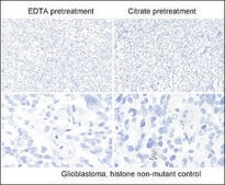 Anti-Histone H3 K27M antibody, Rabbit Monoclonal recombinant, expressed in HEK 293 cells, clone RM192, purified immunoglobulin