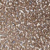 Anti-ALDH4A1 antibody produced in rabbit Prestige Antibodies® Powered by Atlas Antibodies, affinity isolated antibody, buffered aqueous glycerol solution