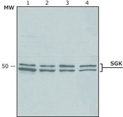 Anti-SGK antibody produced in rabbit buffered aqueous solution, IgG fraction of antiserum