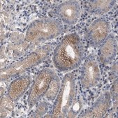 Anti-BTN2A1 antibody produced in rabbit Prestige Antibodies® Powered by Atlas Antibodies, affinity isolated antibody, buffered aqueous glycerol solution