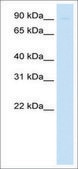 Anti-SIRT1 antibody produced in rabbit affinity isolated antibody