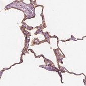 Anti-GPRC5A antibody produced in rabbit Prestige Antibodies® Powered by Atlas Antibodies, affinity isolated antibody, buffered aqueous glycerol solution