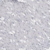 Anti-ACSF2 antibody produced in rabbit Prestige Antibodies® Powered by Atlas Antibodies, affinity isolated antibody, buffered aqueous glycerol solution