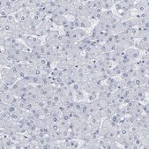 Anti-GNAS antibody produced in rabbit Prestige Antibodies® Powered by Atlas Antibodies, affinity isolated antibody, buffered aqueous glycerol solution