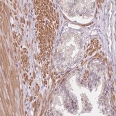 Anti-SMPD4 antibody produced in rabbit Prestige Antibodies® Powered by Atlas Antibodies, affinity isolated antibody, buffered aqueous glycerol solution