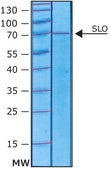 Streptolysin O from Streptococcus pyogenes γ-irradiated
