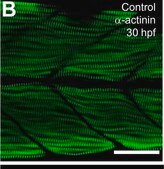 Monoclonal Anti-α-Actinin (Sarcomeric) antibody produced in mouse clone EA-53, ascites fluid