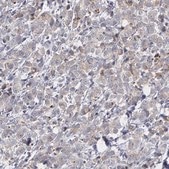 Anti-ERBB2 antibody produced in rabbit Ab1, Prestige Antibodies® Powered by Atlas Antibodies, affinity isolated antibody, buffered aqueous glycerol solution