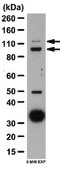 Anti-Autotaxin Antibody from rabbit, purified by affinity chromatography