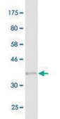 Monoclonal Anti-PARP1, (N-terminal) antibody produced in mouse clone 2C7, purified immunoglobulin, buffered aqueous solution