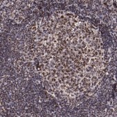 Anti-LONP1 antibody produced in rabbit Ab2, Prestige Antibodies® Powered by Atlas Antibodies, affinity isolated antibody, buffered aqueous glycerol solution