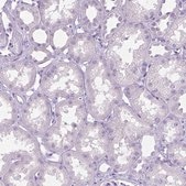 Anti-MMP9 antibody produced in rabbit affinity isolated antibody, buffered aqueous glycerol solution