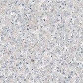 ANTI-MDC1 antibody produced in rabbit Prestige Antibodies® Powered by Atlas Antibodies, affinity isolated antibody, buffered aqueous glycerol solution