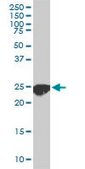 Monoclonal Anti-CLPP antibody produced in mouse clone 300, purified immunoglobulin, buffered aqueous solution